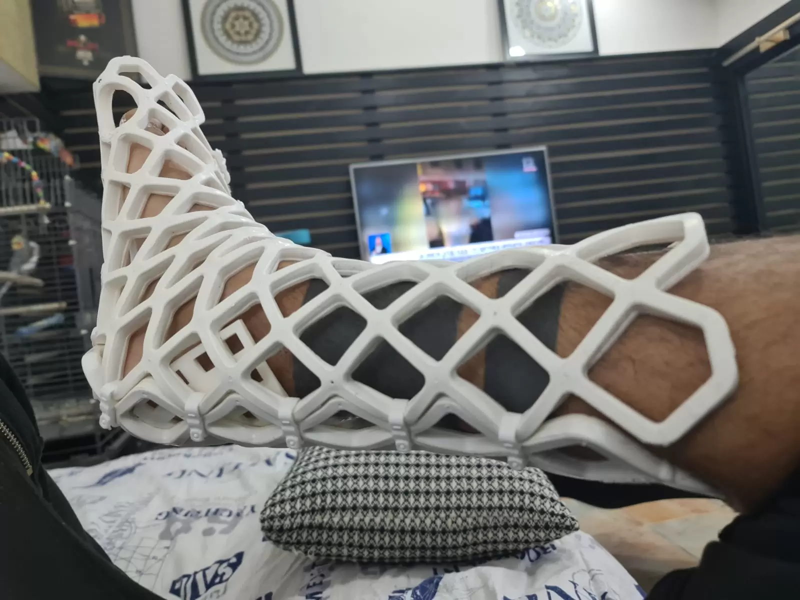 גבס קל לרגל