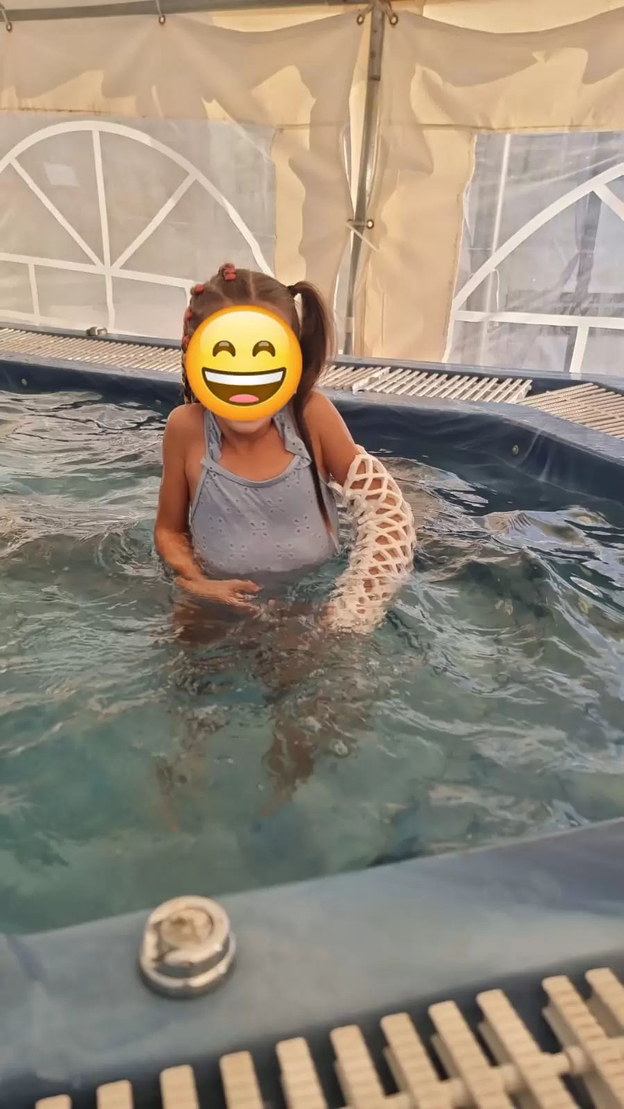 OpenCast ליד, גבס קל